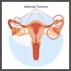 Gynecology (Female disorders)